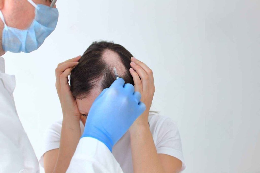 Alopecia Areata Treatment - Twacha Aesthetic Hair Clinic