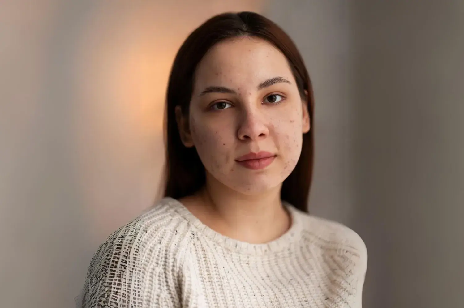 Pigmentation in face