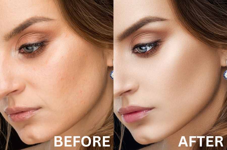 Laser Pigmentation Removal Clinic In Nagpur