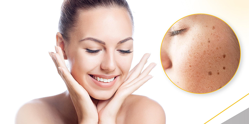 Pigmentation Treatment In Nagpur