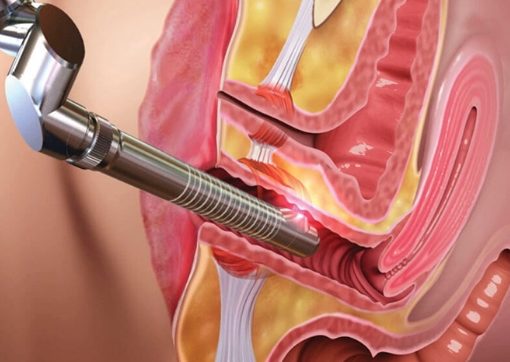 Vaginal Tightening In Nagpur